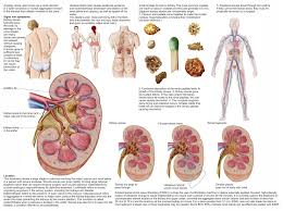 Amazon Com Posterazzi Medical Chart Showing The Signs And