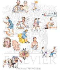 Image result for Polymyositis Management