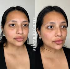 𝑼𝒏𝒅𝒆𝒓𝒆𝒚𝒆, 𝒏𝒐𝒔𝒆 & 𝒄𝒉𝒊𝒏