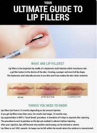 Lipfillersgonewrong Botox Fillers Lip Fillers Dermal Fillers Lips