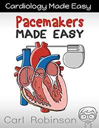 A pacemaker is a small device that's placed under the skin of the chest or abdomen to help control abnormal heart rhythms. Pacemakers Made Easy The Pacemaker Manual Cardiology Made Easy Book 2 English Edition Ebook Robinson Carl Amazon De Kindle Shop