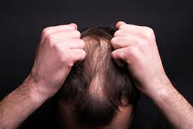 Sugarbearhair contains biotin, b12 and other clinically proven ingredients to support hair growth. Finasteride Results A Two Year Timeline Online Prescription Medications