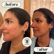 𝘋𝘈𝘕𝘐 𝘚𝘏𝘐𝘌𝘓𝘋𝘚, 𝘏𝘖𝘓𝘐𝘚𝘛𝘐𝘊 𝘓𝘌