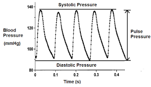 Image result for Pulse Pressure