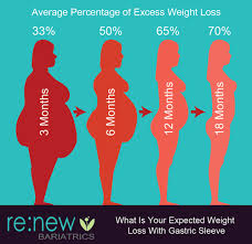 Pin On Bariatric Surgery