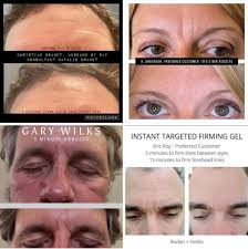 Rodan + Fields: Natalie Brandt- Independent Consultant