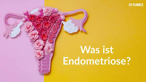 Endometriose 13 Symptome Ursachen Und Behandlung Bildderfrau De