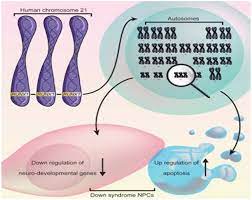 Down Syndrome Regenerative Medicine Taming The Over Expressive Trisomy Chromosome 21 Genes Maplespub