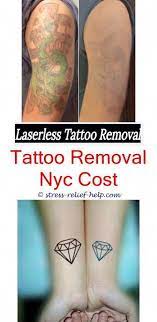 Testimonials Zur Entfernung Von Tatowierungen Tattoo Testimonials Zur Entfernung Von Tatowierungen Entfernt Jane Ihre Tatowierungen Welche Creme Nach