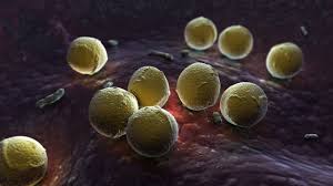 These bacteria tend to cause most acute streptococcal diseases. Streptococ Betahemolitic Grup A Divahair Ro