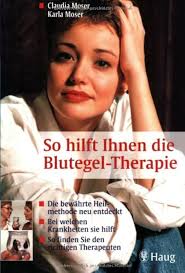 So hilft Ihnen die Blutegel-Therapie: Die bewährte Heilmethode neu  entdeckt. Bei welchen Krankheiten sie hilft. So finden Sie den richtigen ...