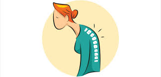Oct 24, 2018 · start by doing chin tucks of the neck where you pull the chin straight back. The Dowager S Hump Prevention Treatment Melt Method