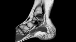 Foot and (from schuenke m, schulte e. Ankle Mri Anatomy Youtube