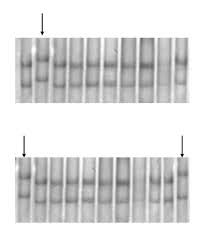 Descargar vídeos, mp3 de youtube para pc, móvil, android, ios gratis. Alterations Of Tumor Suppressor Gene P16 Ink4a In Pancreatic Ductal Carcinoma Springerlink