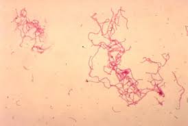 Image result for chancroid