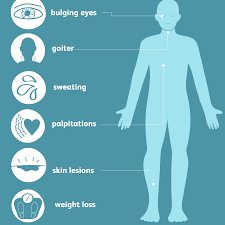 The three treatment options for graves' disease are medicine, radioiodine therapy, and thyroid surgery, according to the niddk. Graves Disease Overview And More