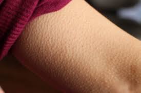Why Do You Get Goosebumps Health Essentials From Cleveland Clinic Goosebumps is a series of children's horror fiction novels by american author r. why do you get goosebumps health