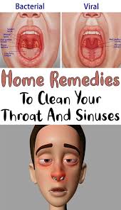 Home Remedies To Clean Your Throat And Sinuses Simple Tips For You In 2020 Remedies For Swollen Tonsils Sinusitis Home Remedies For Sinus