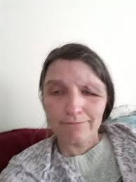 So as some of y'all know I lost my sight last year. I'm completely blind in  my right eye and have 10 to 15% vision in my left. Well, something just kind