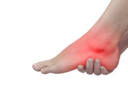 Image result for Vasculitis