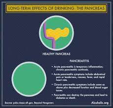 We all began with a sore throat and hoarseness, some had a 'strange' headache. Hangover Symptoms Sore Throat Stomach Pain Alcohol Org