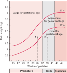 small for gestational age chart google search