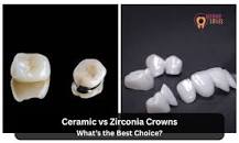 Ceramic vs Zirconia Crowns: Which One Should You Choose ...