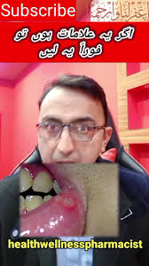 Don't Ignore These Signs #fypシ #fyp #foryoupage #anemia