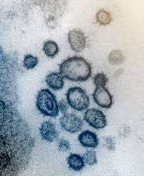 The Coronavirus Outbreak Exposes Our Health Care System S Weaknesses