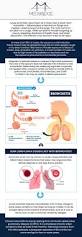 Image result for Acute Bronchitis