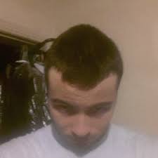 We did not find results for: Is My Hairline Receding More On My Right Side Photo