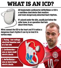 Sep 30, 2016 · however, the headphones used with mp3 players can interfere with both devices. What Is An Icd Implant For The Heart