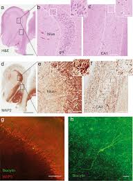 Maybe you would like to learn more about one of these? Inhibition Of Epileptiform Activity By Neuropeptide Y In Brain Tissue From Drug Resistant Temporal Lobe Epilepsy Patients Scientific Reports