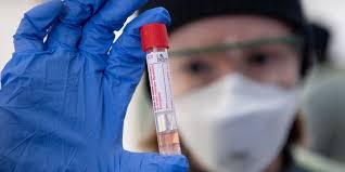 2 In 3 Early Covid 19 Tests Show False Negative Study Shows