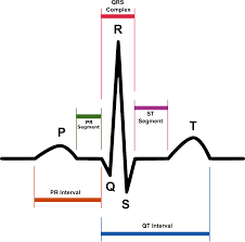 The ekg is used to determine heart rate, heart rhythm and other information regarding the heart's condition. Electrocardiography Wikipedia