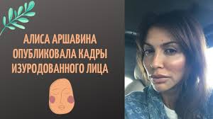 «все началось с такой резкой центрифуги, что мы не могли уже ничего. Alisa Arshavina Opublikovala Kadry Izurodovannogo Lica Youtube