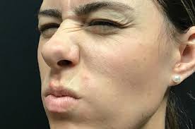 Dysport en Reno, Sparks y Hidden Valley, NV Reno NV