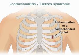 Air reaches the lungs through the trachea, located beneath the throat. 13 Common Causes Of Pain Under Left Rib Cage With Treatments