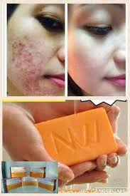 Nworld products by Glaizar in kuwait‎