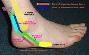 Pin On Treat Your Feet