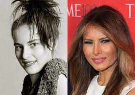 Melania trump plastic surgery 2021. Melania Trump Before And After Celebrity Plastic Surgery Bad Plastic Surgeries Plastic Surgery Fail