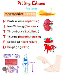 Image result for Localized Edema