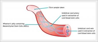 Storing cord tissue with cord blood maximises the amount of cells within the sample and additionally offers a larger volume of cells available for future treatments. Cord Tissue Medcells Cord Blood Banking