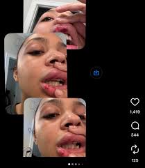 Preme Sports | Rashee Rice is facing serious allegations from his girlfriend,  who shared photos of bruises and injuries and posted a detailed account  of... | Instagram