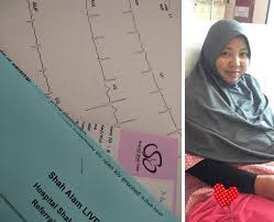 Nyeri perut dapat terasa dalam berbagai sensasi. Ada Ketulan Besar Di Perut Bila Ditekan Sakit Disangka Angin Rupanya Cyst Ibu Ni Kongsikan Deritanya Keluarga