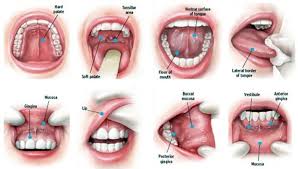 Oral cancers are a type of head and neck cancer. Oral Cancer Screening Exam Los Angeles La Periodontal Experts