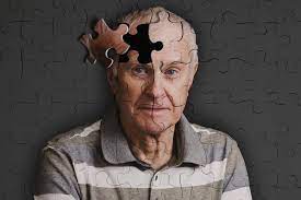 Malhar o cérebro ajuda a combater Alzheimer e demências, diz médico | Metrópoles