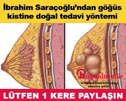 Ibrahim Saracoglu Tarifi Ile Gogusteki Fibroadenom Yani Kistleri Yok Eden Dogal Tedavi Yontemi Dogal Tedaviler Saglik Dogal