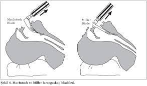 Ohaaa favlayınca simgesi çıkıyor #laringoskop pic.twitter.com/qtfsmjpspk. Laringoskop Tiplopedi