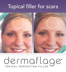 Dermaflage store scar filler